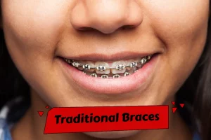 Braces and wires are effective methods for adjusting teeth position, but they can take longer and require more maintenance than traditional methods.